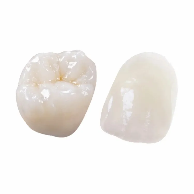 Buccal Ceramic IPS Emax Crown